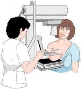 obrázek mamografu