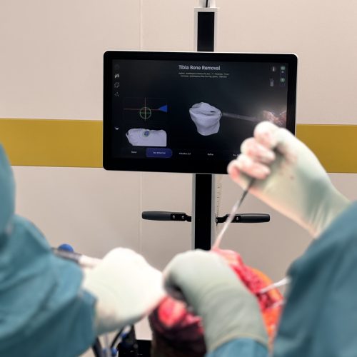Lékaři jihlavské nemocnice provedli první roboticky asistovanou částečnou náhradu kolenního kloubu